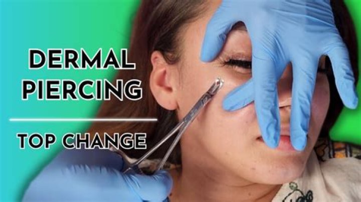 Back Dermals: Everything You Need to Know About This Body Modification Trend