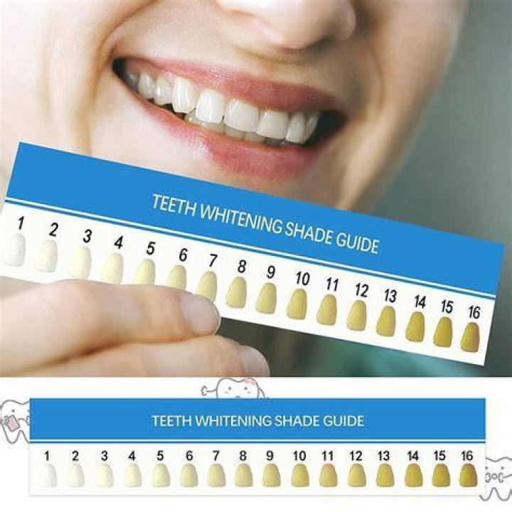 Comprehensive Smileactives Reviews: A Complete Guide to Whiter Teeth