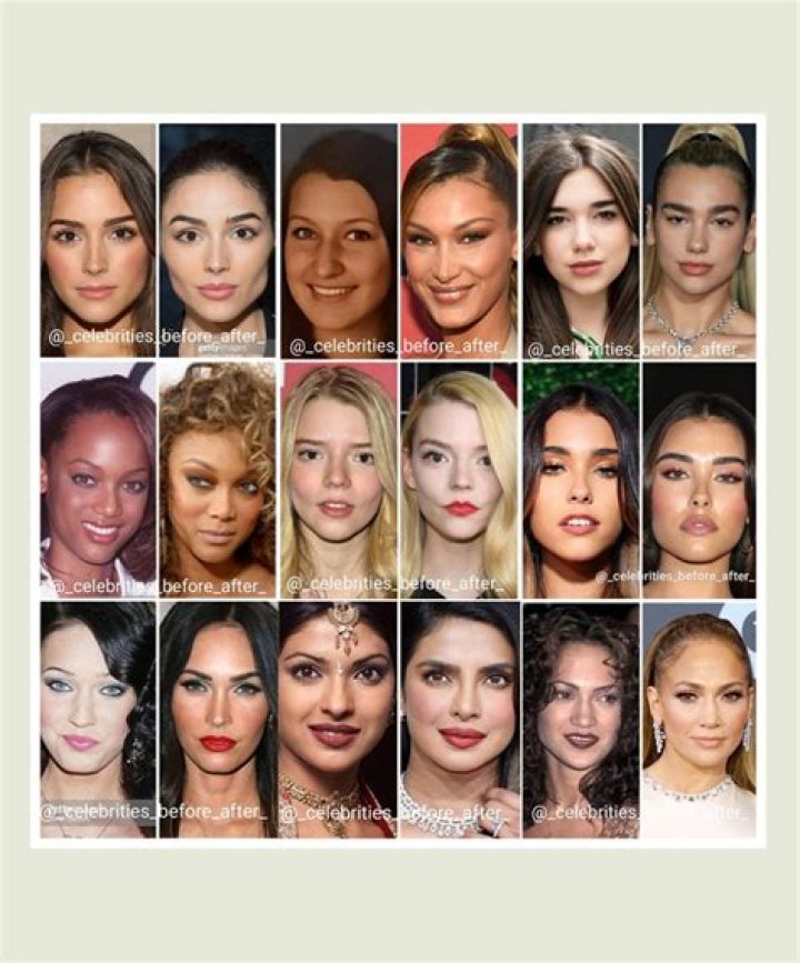 Crowning Glory: Celebrating Celebrities with Large Foreheads