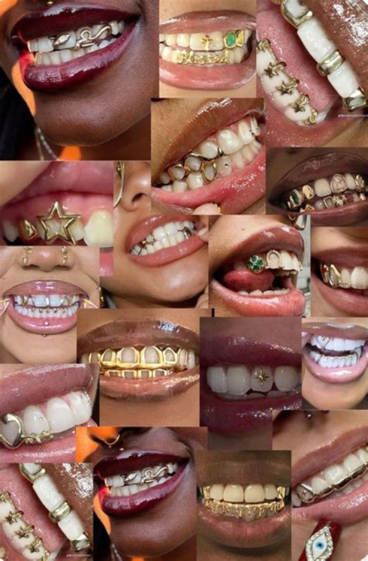 Custom Grillz: The Ultimate Guide to Personalized Dental Jewelry