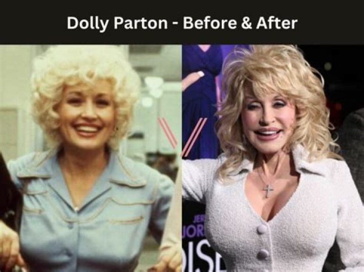 Dolly Parton Boob Job: The Truth Behind the Icon's Transformation