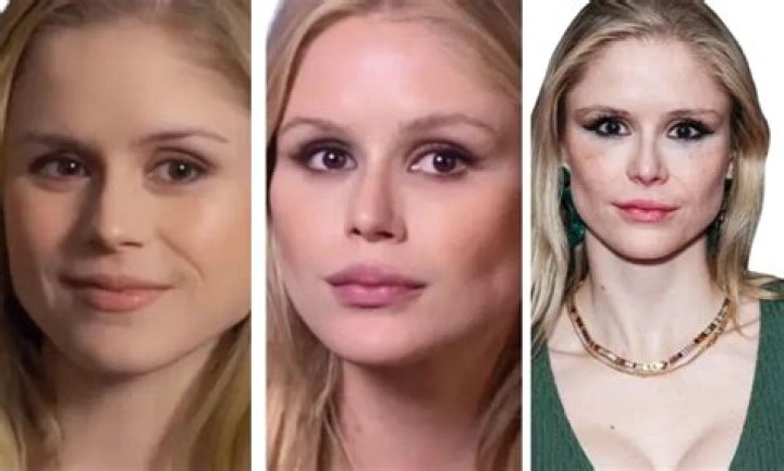 Erin Moriarty Plastic Surgery: The Transformation in 