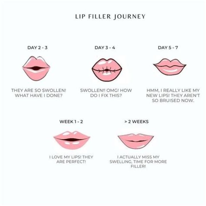 Exploring the Allure of Florence Pugh's Lip Filler Journey