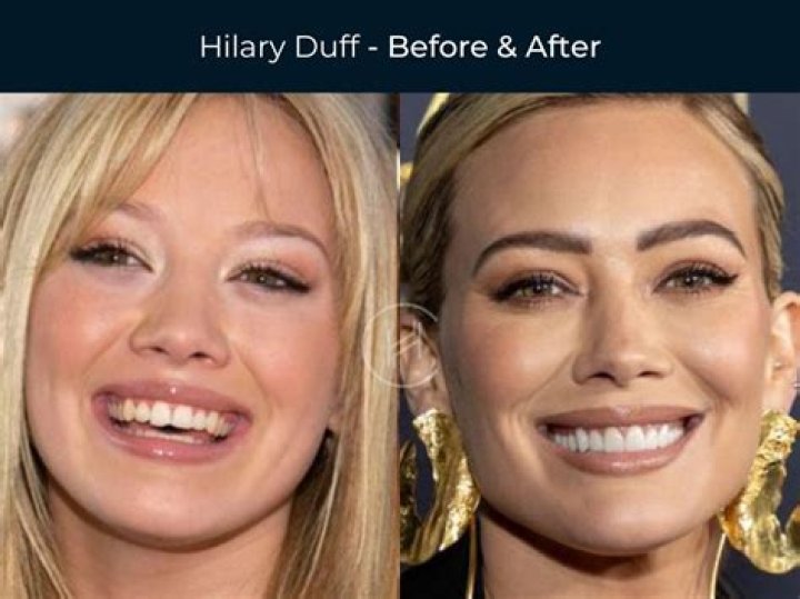 Exploring the Evolution of Hilary Duff: A Look at Her Career and Iconic Moments