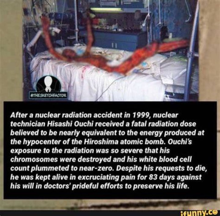 Exploring the Tragic Story of Hisashi Ouchi: A Cautionary Tale of Nuclear Radiation