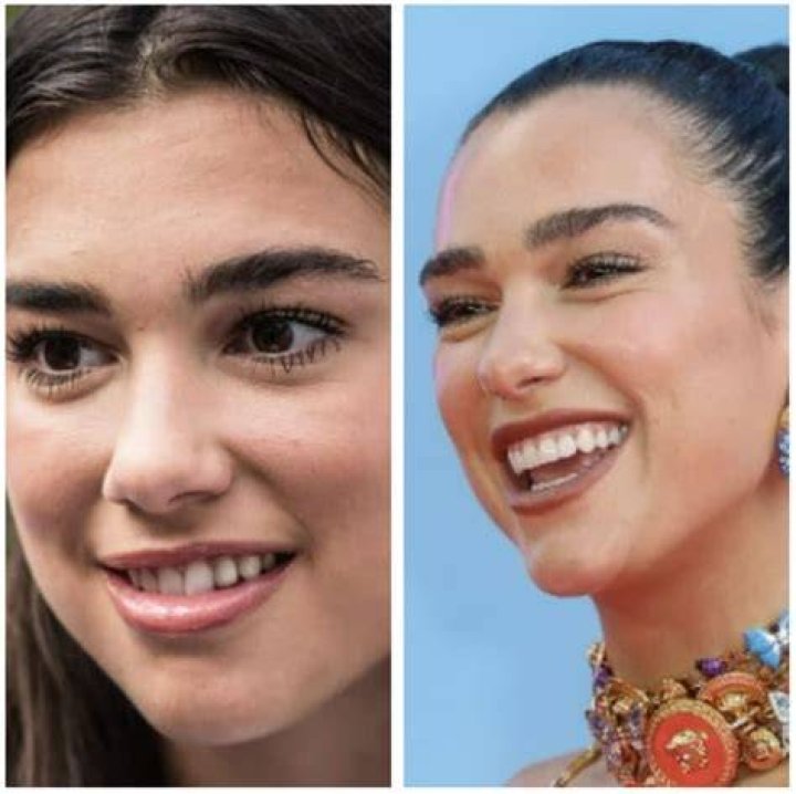Famous Celebrities with Bell's Palsy