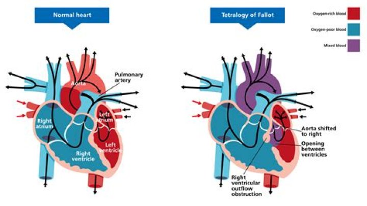 Half Heart on the Thumb Nails: Understanding the Trend and Its Significance
