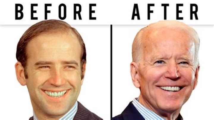 Joe Biden Plastic Surgery: An In-Depth Look