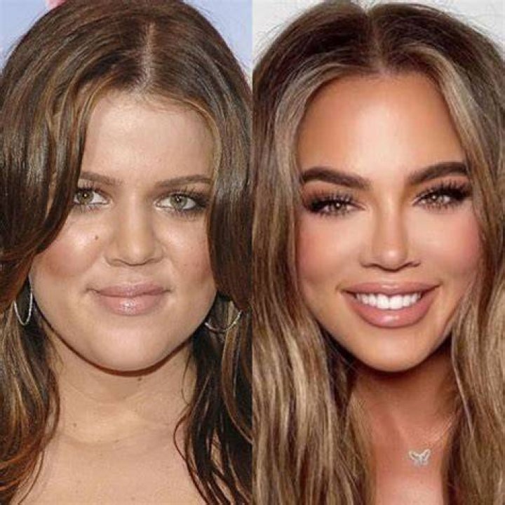 Khloe Kardashian before and after