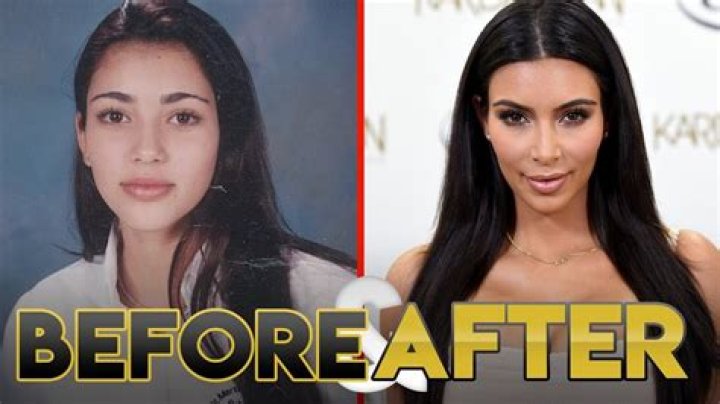 Kim Kardashian before and after