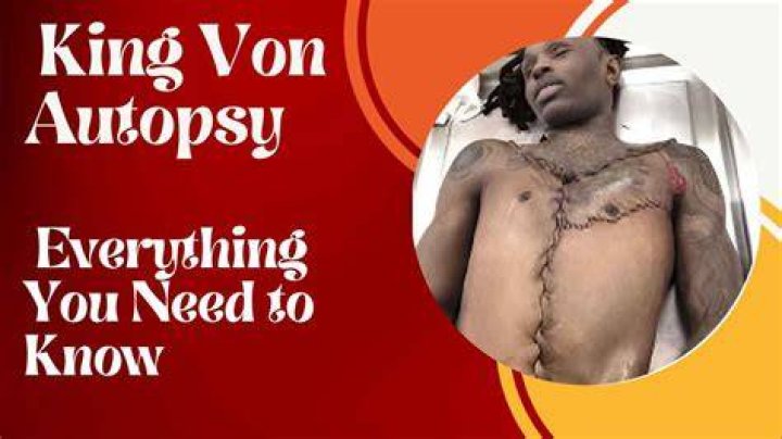 King Von Autopsy Report: Understanding the Tragic Story Behind the Headlines
