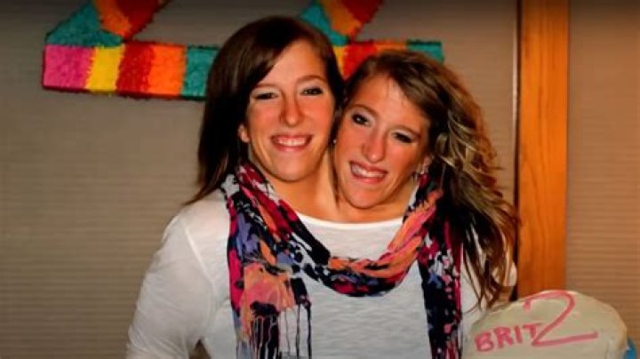 Meet Abby and Brittany: The Extraordinary Conjoined Twins Set to Inspire in 2024