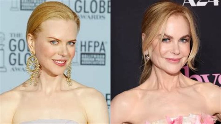 Nicole Kidman Young: A Journey Through Her Early Years and Rising Stardom