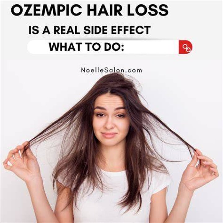 Ozempic Hair Loss: Understanding the Connection and Solutions