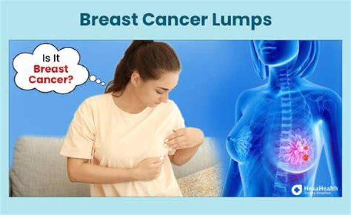 Real Pictures of Breast Cancer Lumps: Understanding the Signs and Symptoms