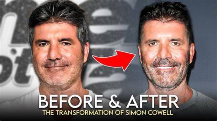 Simon Cowell Before and After: A Comprehensive Transformation Journey