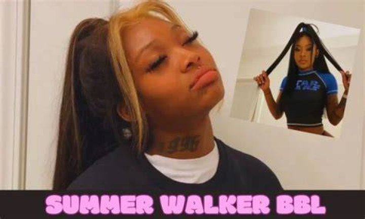 Summer Walker BBL: Everything You Need to Know About the Singer's Transformation