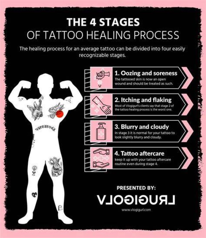 Tattoo Peeling: What You Need to Know for Proper Aftercare