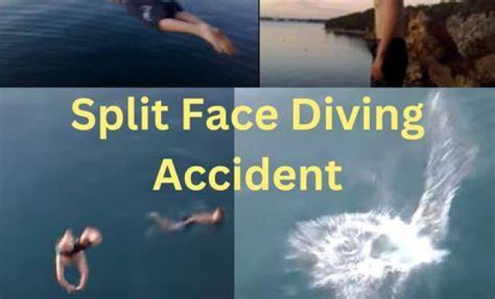 The Diving Face Split: Understanding the Phenomenon and Its Implications