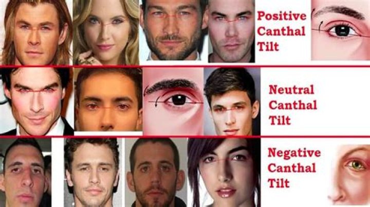 The Power and Allure of an Attractive Negative Canthal Tilt