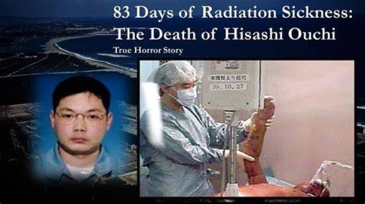 The Tragic Story of Hisashi Ouchi: Real POS Hospital Incident