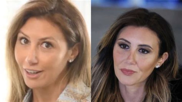 The Transformation Journey: Alina Habba Before and After Plastic Surgery