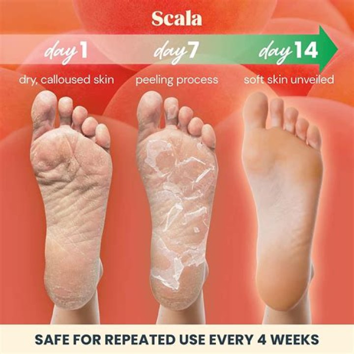 The Ultimate Guide to Foot Peel: Transform Your Feet with Exfoliation