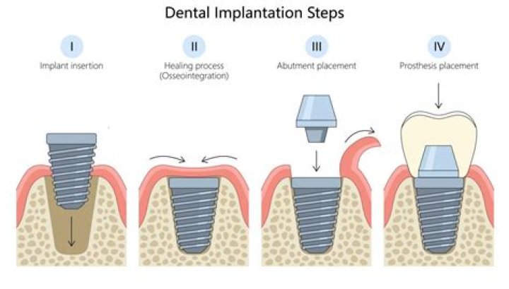 Top Zahn Dental Services & Procedures