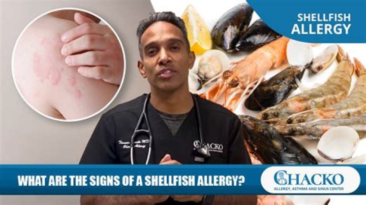 Understanding and Managing Hitch Allergic Reaction: An In-Depth Guide