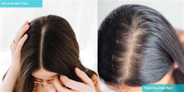 Understanding Hair Parts: Why Your Hair Naturally Parts Itself in the Middle