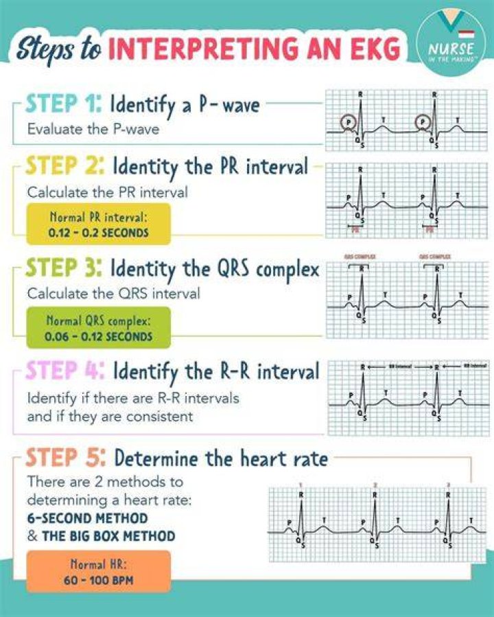 Understanding RR Normal Range: A Comprehensive Guide