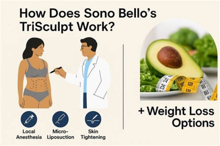 Unlocking the Secrets of Sono Bello: A Comprehensive Guide
