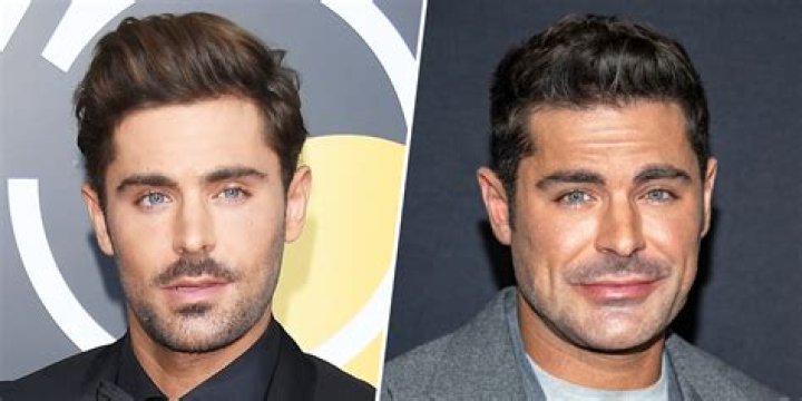 Unveiling the Mystery: What Happened to Zac Efron's Face?