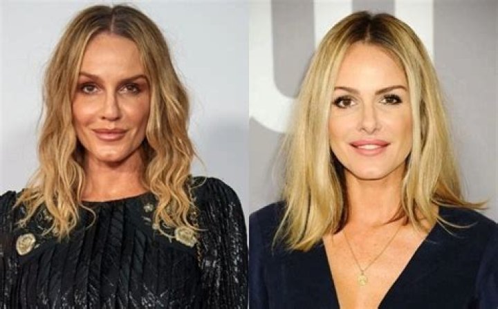 Unveiling the Truth Behind Monet Mazur's Nose Job