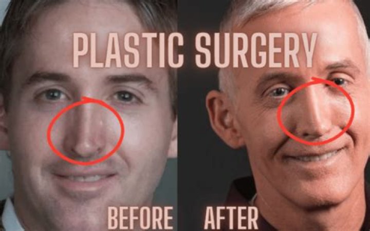 What Happened to Trey Gowdy's Nose: A Deep Dive into His Transformation