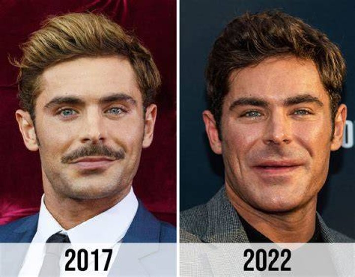 Zac Efron's Face Change: An In-Depth Look at His Transformation